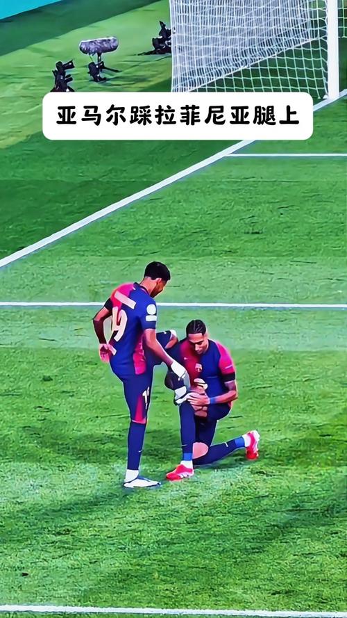 RAC1:拉菲尼亚腿筋受伤,但预计伤势并不严重