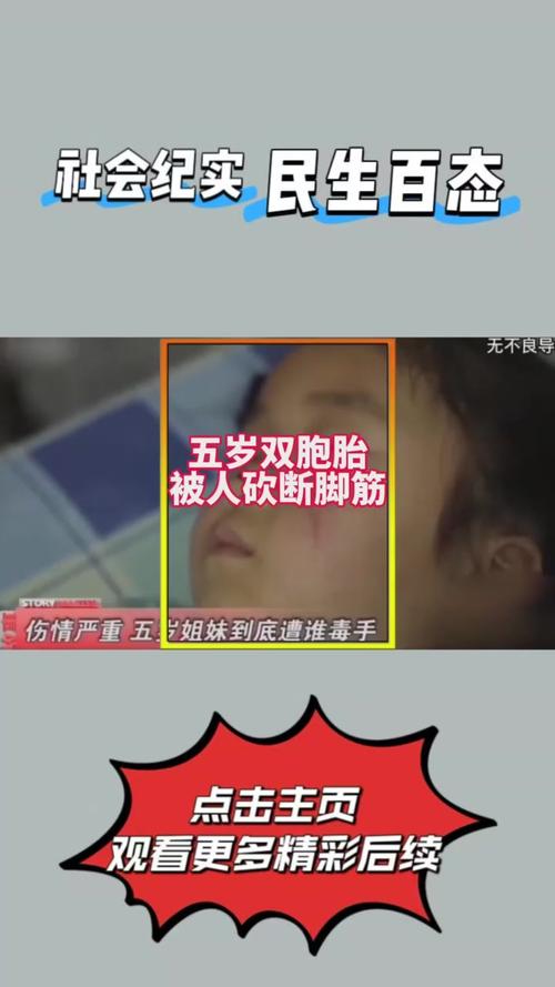 过去三年五遭腿筋重伤!TA谈阿利森伤病:技术动作存在不合理