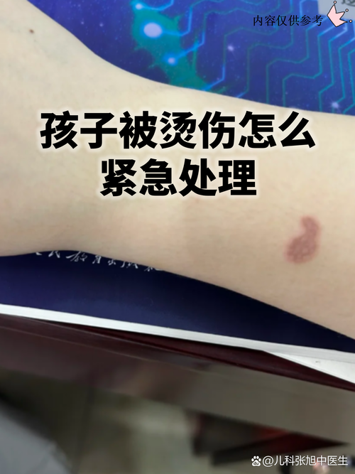 家长冲进场推倒球员！媒体人：事事都要家长出头 不是教育 是有病